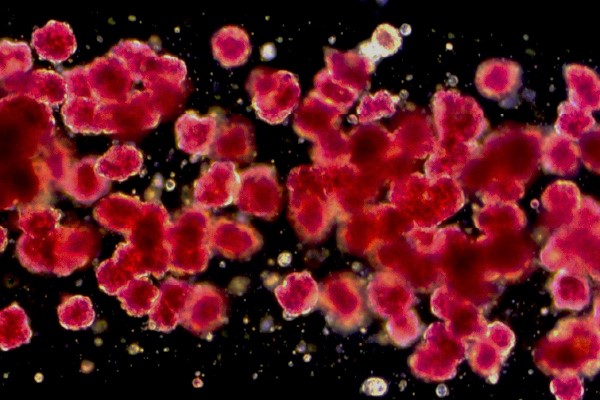 Pancreatic Tissue Therapeutic